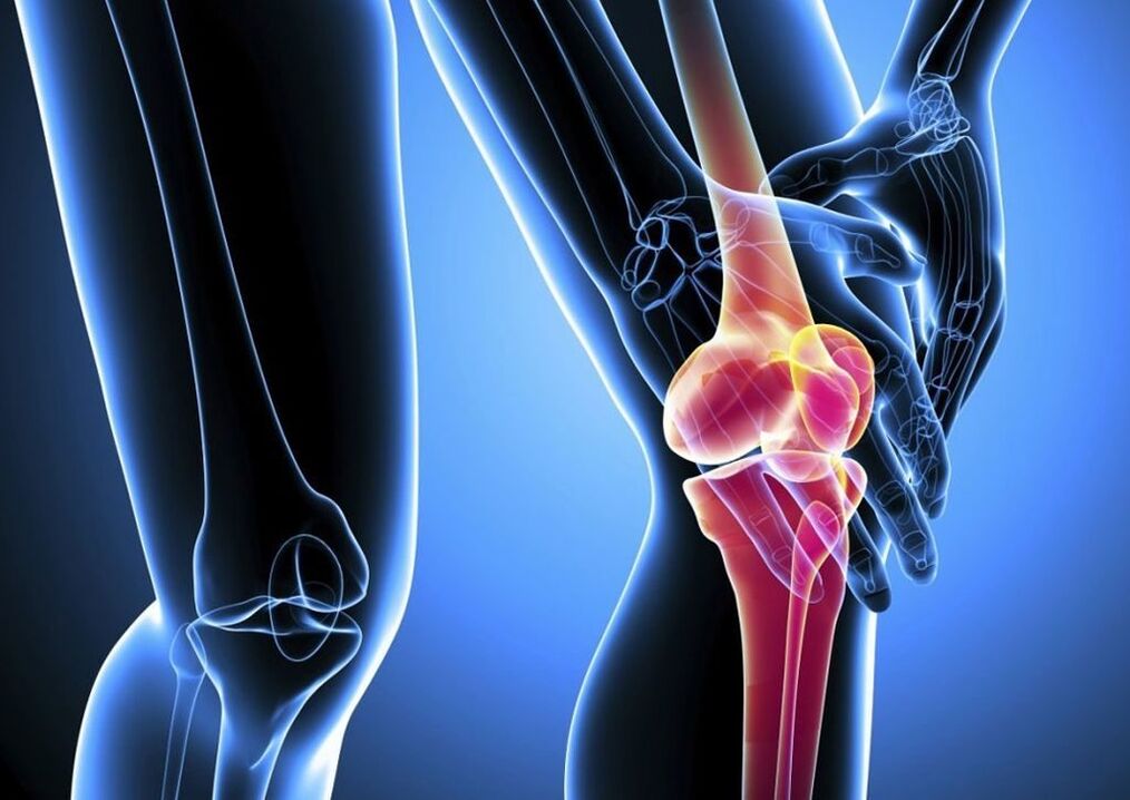 Bolest při fyzické aktivitě při artróze kolenního kloubu