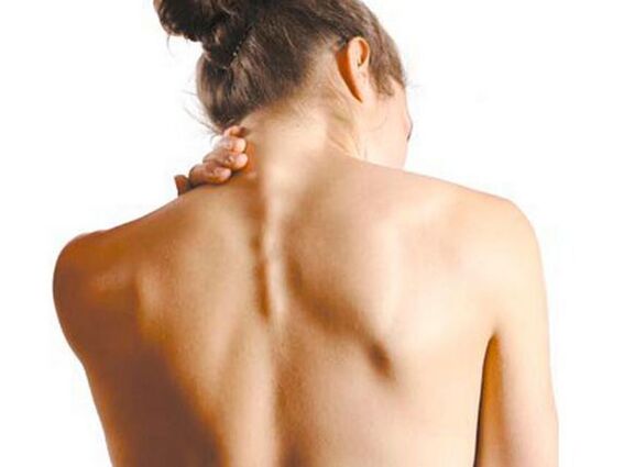 Dívka má cervikální osteochondrózu