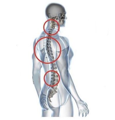 místa spinální osteochondrózy