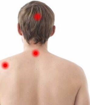 místo bolesti při cervikální osteochondróze