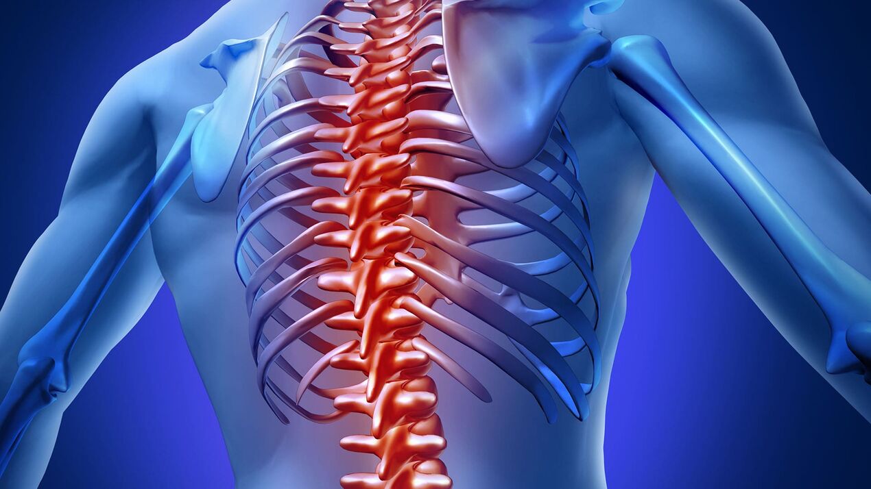 Hrudní osteochondróza