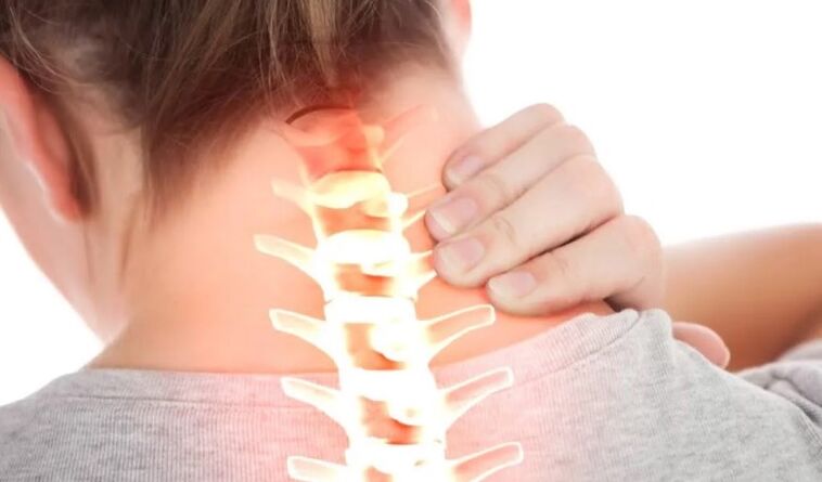 Osteochondróza I stupně